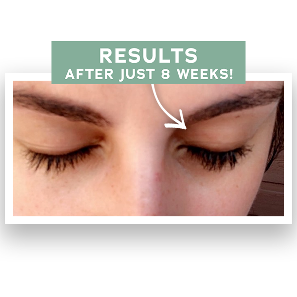 Park Perfection Lash Enhancing Serum Before/After Photo